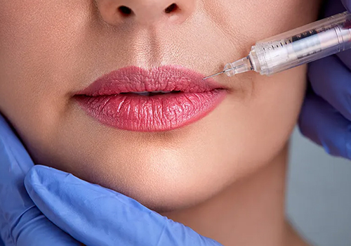 Dermal Fillers In Brighton at Angel Aesthetics